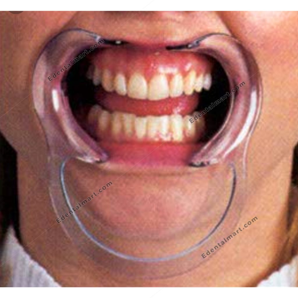 Cheek Retractor Buy Cheeck Retractor Online in Pakistan EDental Mart